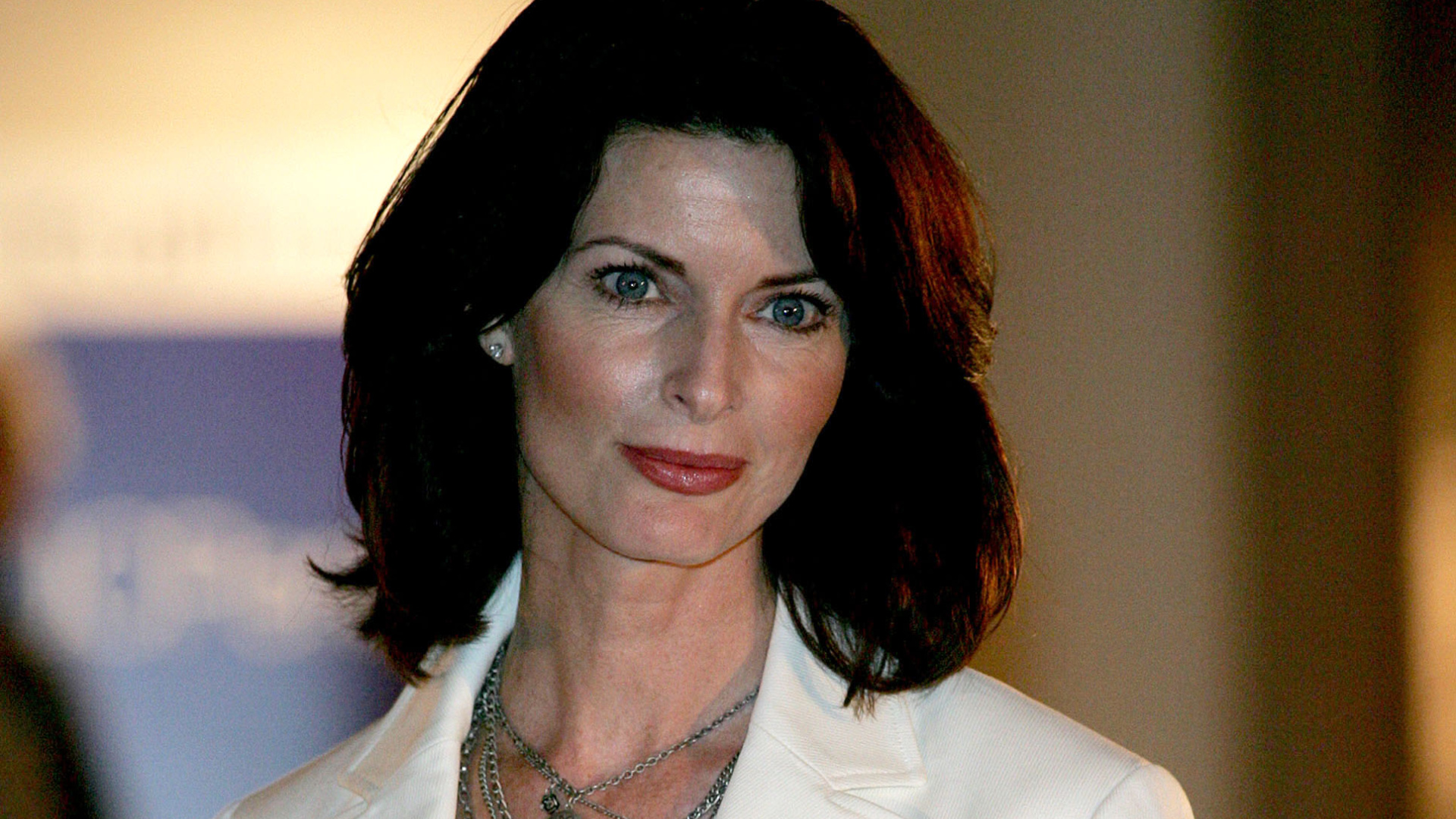 Conviviendo con el vitiligo